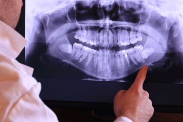Best Emergency Tooth Extraction in Glenolden, PA